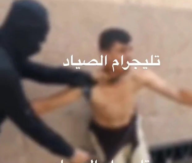 Thief shot in the legs by hamas fighters for stealing humanitarian aid