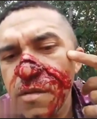 Biker vs. Barbed Wire