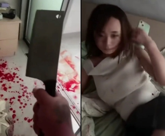 Chinese girl attacked by her angry ex-boyfriend using meat cleaver 
