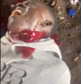 African Dude With Hole In His Neck & Blood Gushing Out