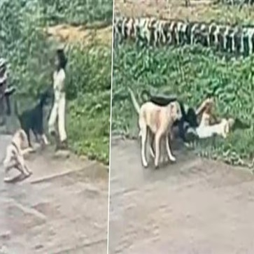 3-Year-Old Girl Mauled by 2 Stray Dogs on Street, Dragged and Bitten As She Screams for Help