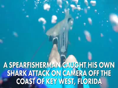 Horrific Moment 8Ft Shark Took A Huge Bite Out Of Spear Fisherman's Leg