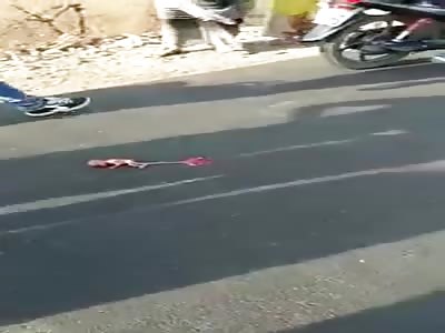 fetus ejected from the mother's belly after brutal accident