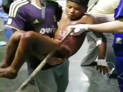 KiD IMPALED BY IRON PIPE