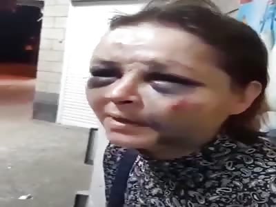 Shocking face of Russian wife after husband beating 