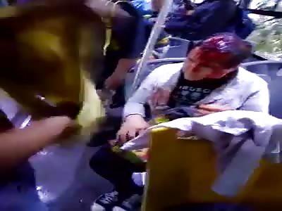 Tree fall on bus hit passenger on his forehead 