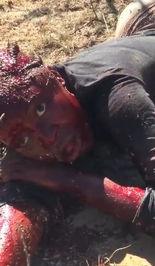 Aftermath of Bloody Beating by Farmer to Black Woman Thief 