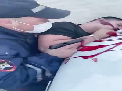 Young Russian gets accidentally head shoot from police 