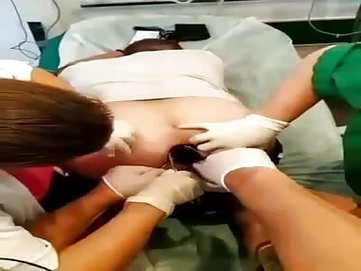 Doctors removing huge plugs stuck in faggot ass