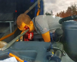 Bus driver ampalled by iron bar to the face