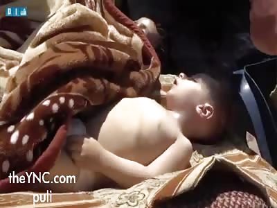 Children dying in the arms of the rescuers after Assad's toxic gas attack.