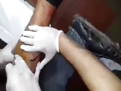 Extraction of bullet in the student's leg