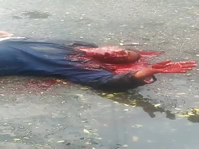 Blood Pours like a Waterfall after Shot in the Head