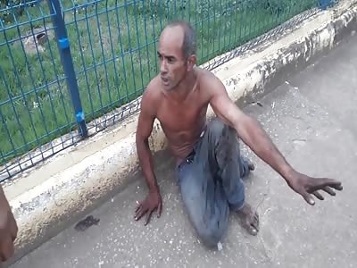 brutally beaten street dweller