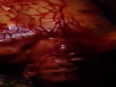 Man Slowly Bleeding out Dying in Total Agony after Knife Attack
