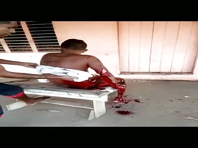 Young Attacked by machete