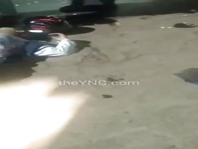 Accident. leaves a woman with a shattered knee