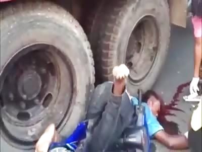 legs trapped by truck wheel