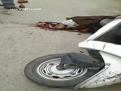 Brutal accident leaves a man with a shattered head