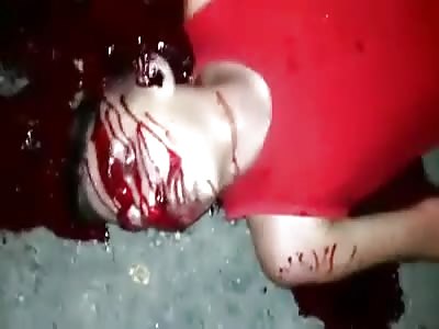 Shot in the Head Lays in a Pool of Blood