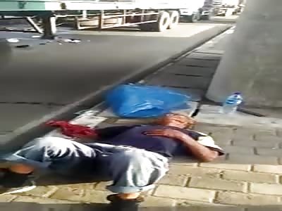 Man in agony after losing his hand in accident