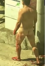 Self-Mutilation While on Drugs (Cut his dick off?)