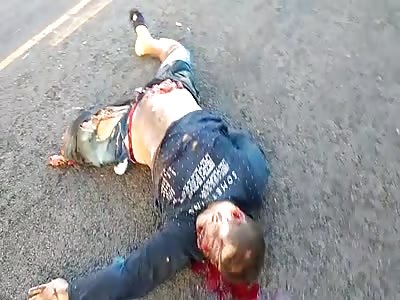 Shocking accident with biker