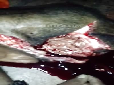 (Restricted to user wall, Kaotic watermark) Brazil. Man killed with gunshot wound to the head 