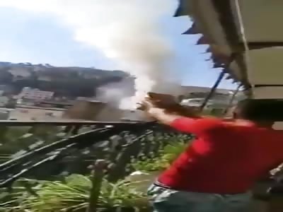 Dude Loses Half his Hand in Firework Accident...OUCH! 