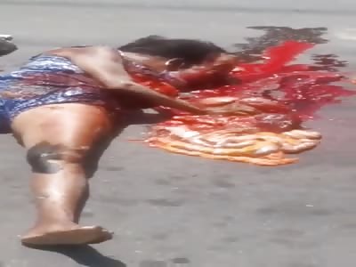 Woman's Guts Fully Exposed After Shocking Accident