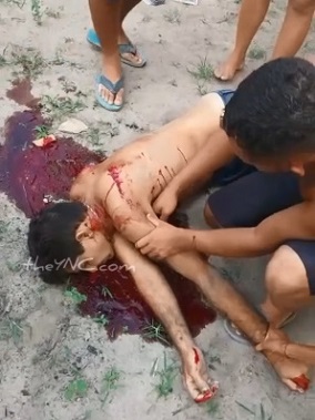 Victim Of Street War Dies In Pool Of Blood