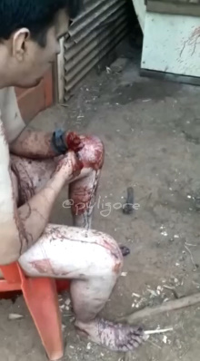 Man's Hand Was Chopped Off While Street Fight