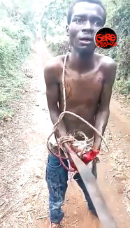Thief Got Palm Nearly Chopped Off By Villagers