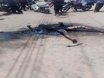 man totally burned after accident