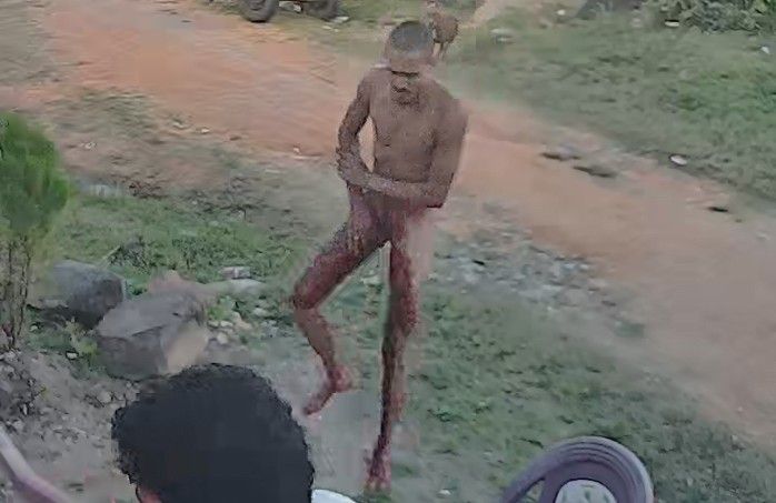 Dumbass Accidentally Shoots Himself In Dick While Playing With Gun