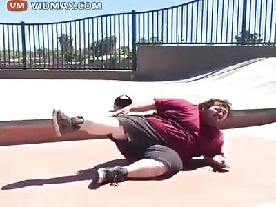 Retard breaks his ankle skateboarding !!