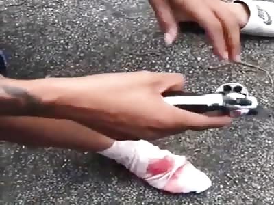 Russian Roulette Ends With Someone Getting Shot In The Foot