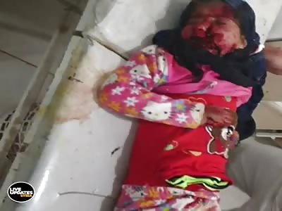 Little Girl Left Bloody And Disfigured By Government Bombing