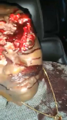 Nigerian Mans Head Cracked Open After Assassination  {Aftermath}