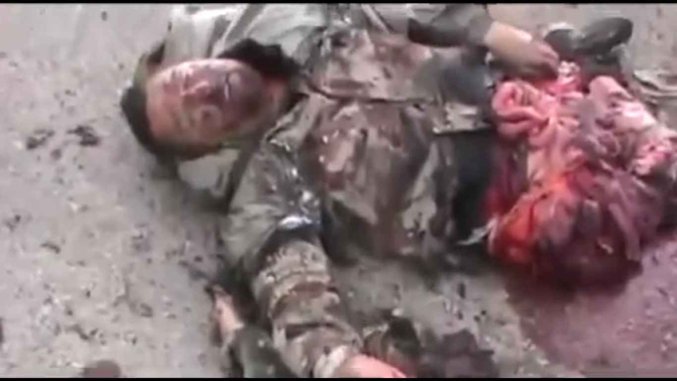 Brutal IED Attack Slowly Kills Soldier