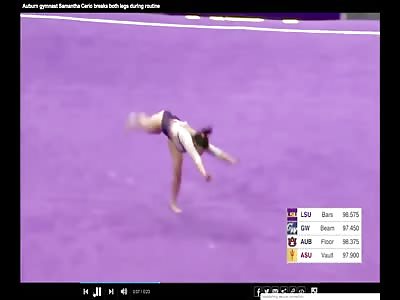Gymnast Samantha Cerio Breaks Both Legs