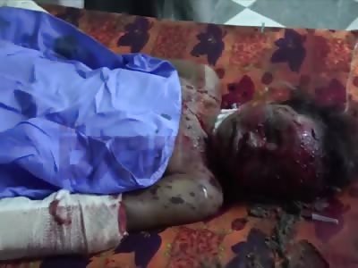 Hodeidah atack airstrike