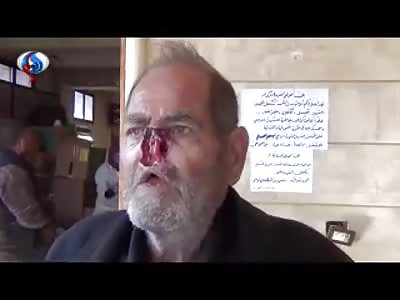 BARBARIC VID: ISIS Cut off Nose of One of Aleppo Residents