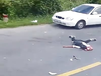 Wait for It..Drive-By Head BUSTED Wide Open:  Motorcycle rider suffers serious accident