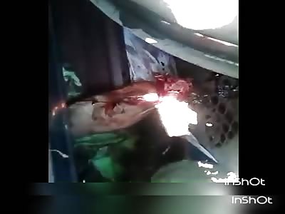 Man crushed under the train