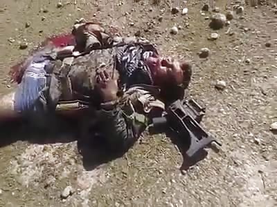 Daesh soldiers seriously injured