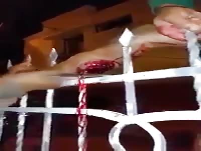 Thief gets leg trapped in railing