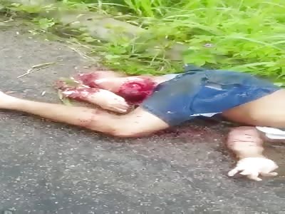 Man gets stranded run over by truck with Gruesome Leg Injury 