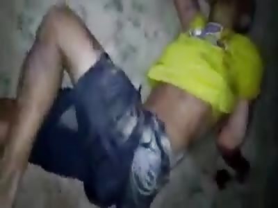 Boy is beaten in favela and has broken arm