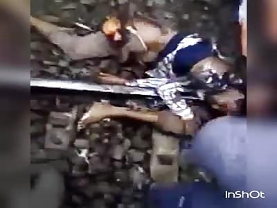 Man in agony in the rails hugs his ripped off leg 